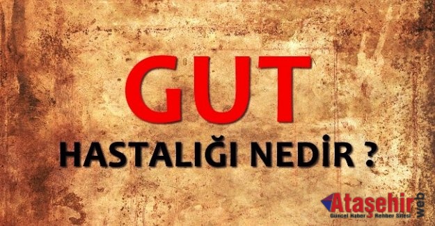 Genç erkeklerde en çok rastlanan hastalık; GUT