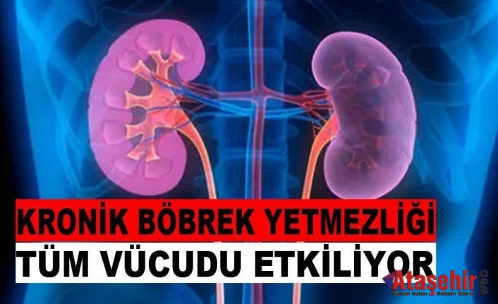 KRONİK BÖBREK YETMEZLİĞİNİN BU BELİRTİLERİNE DİKKAT!