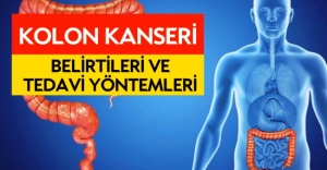 Kolon kanserinde 50 yaş sonrası kontrol önemli