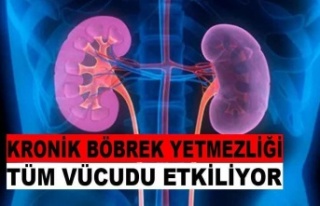 KRONİK BÖBREK YETMEZLİĞİNİN BU BELİRTİLERİNE...