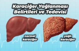 KARACİĞER YAĞLANMASINA KARŞI 3 SİLAHŞOR!